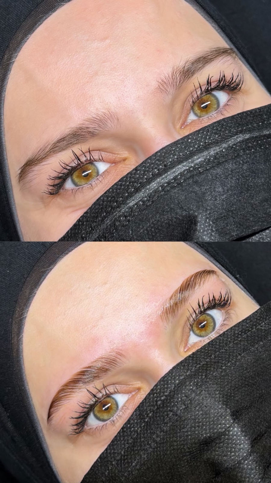 Browlift Naturel, photo 2